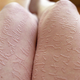 Illustration for article titled Skin Etching Artist Explores Our Relationship With Our Bodies